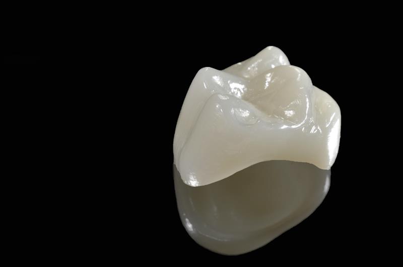 Porcelain Crowns  Salem, UT 